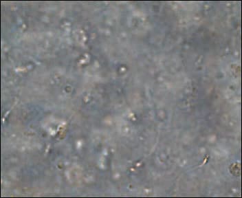 MEDICINA ONLINE VIDEO Sperma e spermatozoi visti al microscopio 1