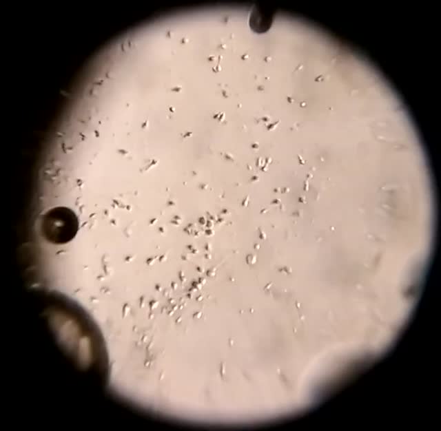 MEDICINA ONLINE VIDEO Sperma e spermatozoi visti al microscopio 2
