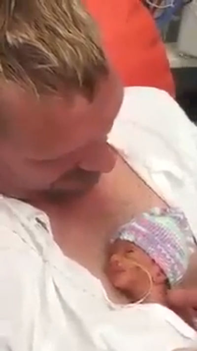 MEDICINA ONLINE VIDEO Neonato prematuro tra le braccia del padre