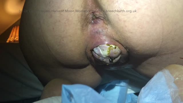 Birth Images Vagina Xxx Hot Porn
