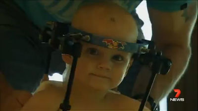 MEDICINA ONLINE VIDEO Jackson Taylor Riattaccata la testa ad un bimbo di 16 mesi decapitato in un incidente