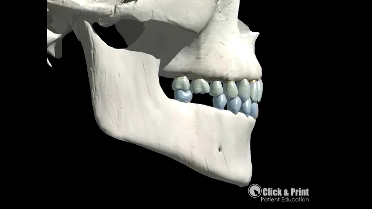 Efeito da perda dentária