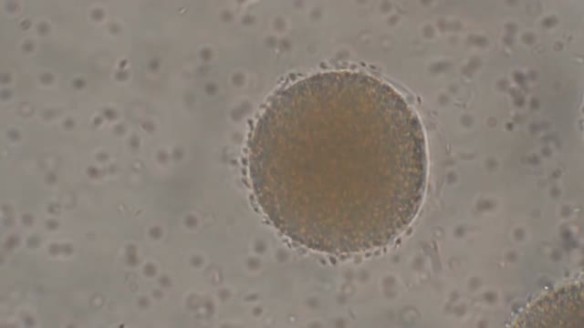 MEDICINA ONLINE VIDEO Incontro tra spermatozoi e cellula uovo al microscopio – When the egg meets sperm