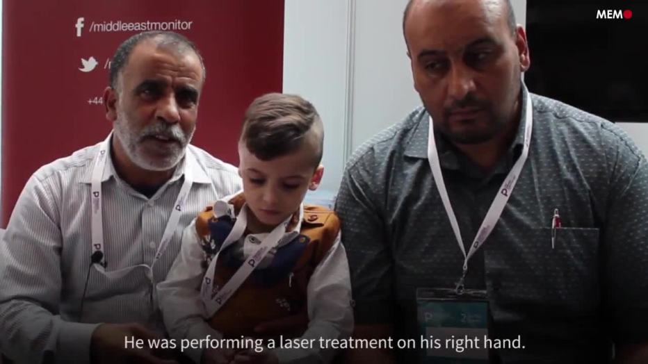 Dawabsheh living with emotional scars following arson attack