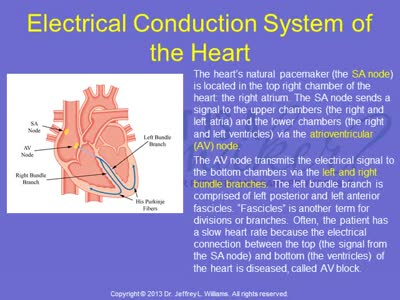 What is a Pacemaker Lecture 1